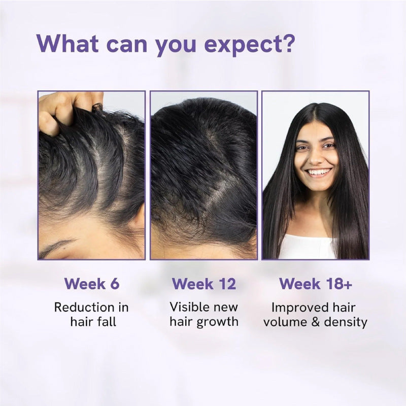 Rosemary Hair Growth Serum with Roller Applicator